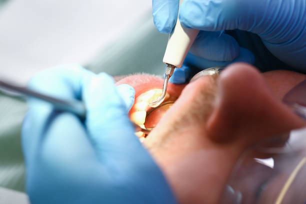 Best After-Hours Dental Trauma Care in Schlusser, PA
