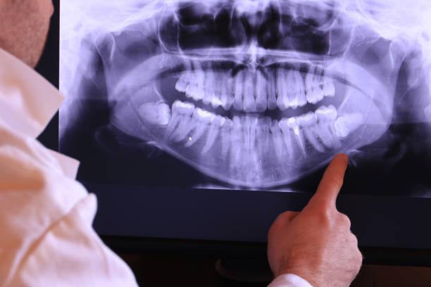 Best Emergency Treatment for Dental Infections or Abscesses in Schlusser, PA