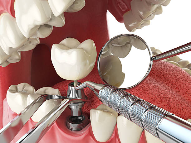 Best Emergency Dental Care for Broken or Chipped Teeth in Schlusser, PA