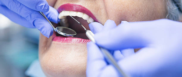 Best Urgent Care for Lost Fillings or Crowns in Schlusser, PA
